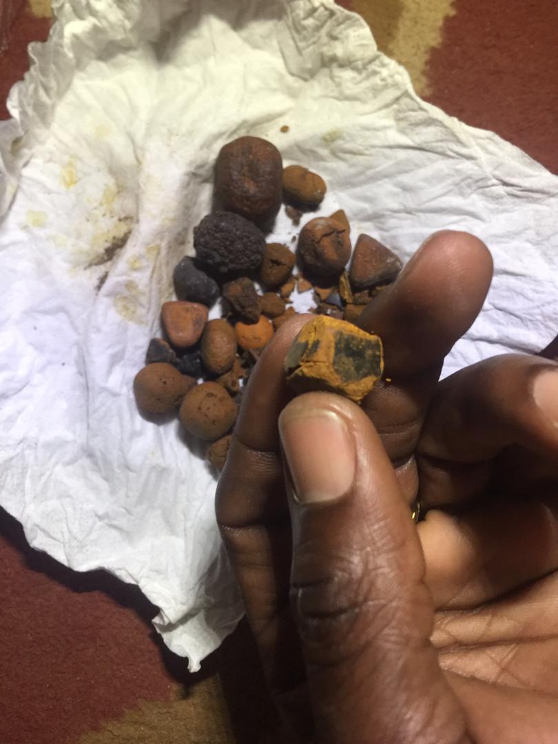 Ox Gallstones for Sale