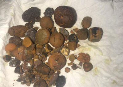 Ox Gallstones for Sale